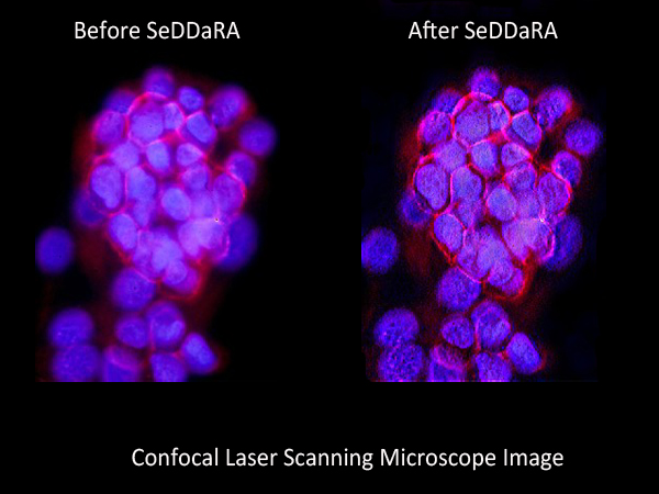 Decon of an image taken by a Confocal Laser Scanning Micropscope
