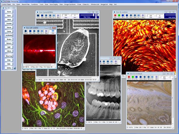 Tria: Advanced Image Processing and Analysis Program
