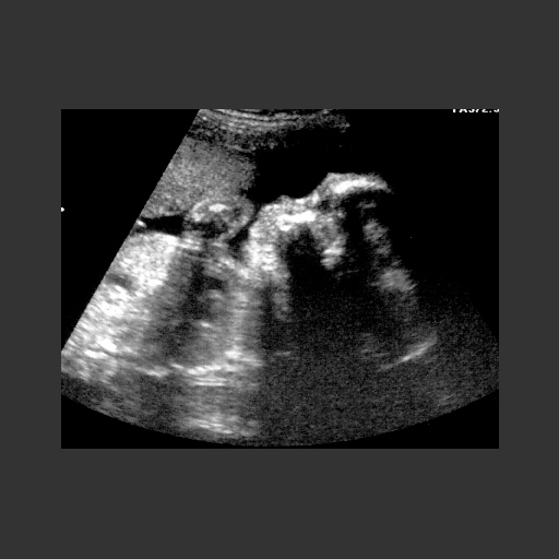 Ultrasound showing my son's profile before birth.
